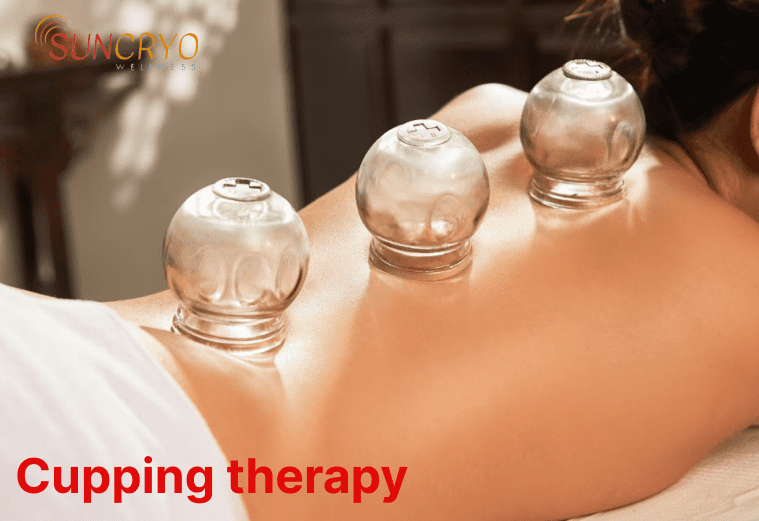 Book Cupping with a massage near Me