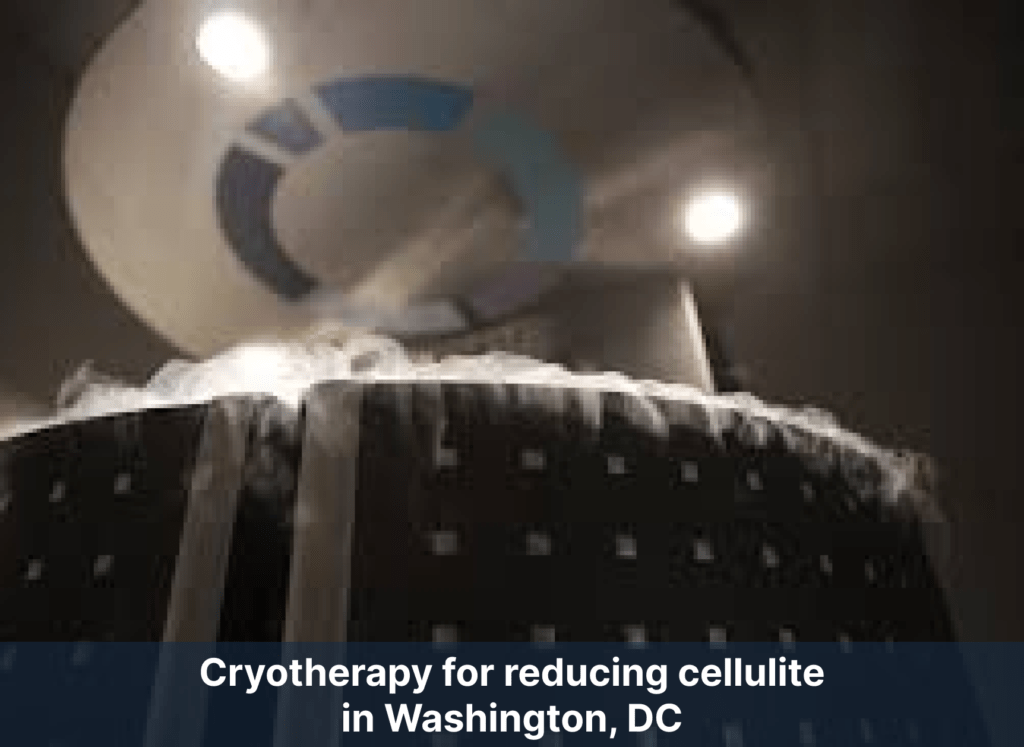 Cryotherapy for reducing cellulite in Washington, DC