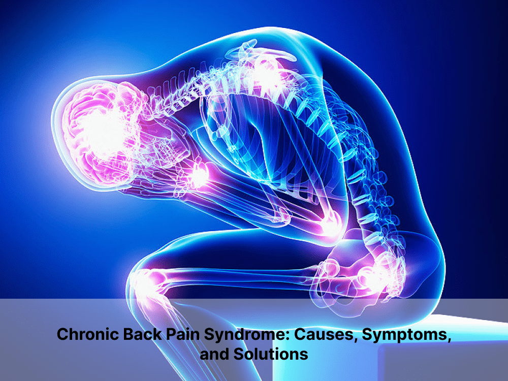 Chronic Back Pain Syndrome: Causes, Symptoms, and Solutions