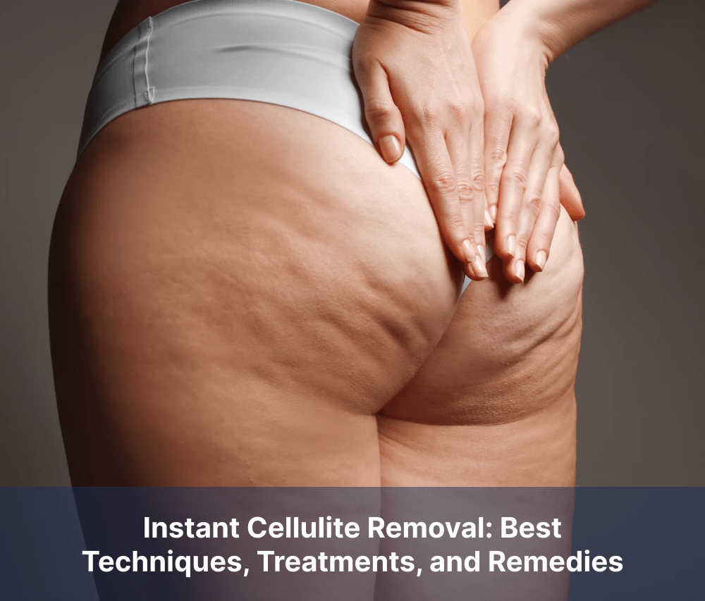 Instant Cellulite Removal: Best Techniques, Treatments, and Remedies