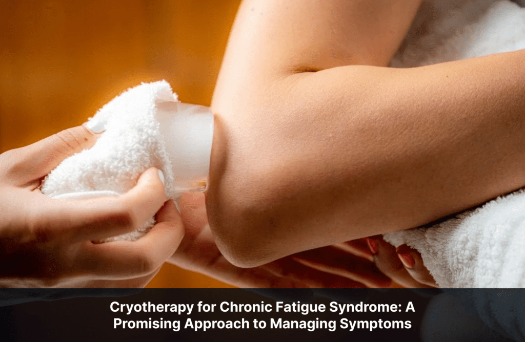 Cryotherapy for Chronic Fatigue Syndrome: A Promising Approach to Managing Symptoms