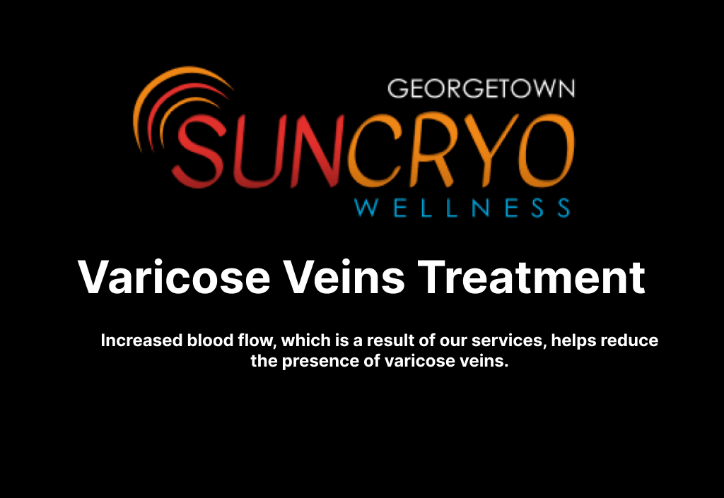 Varicose Veins Treatment