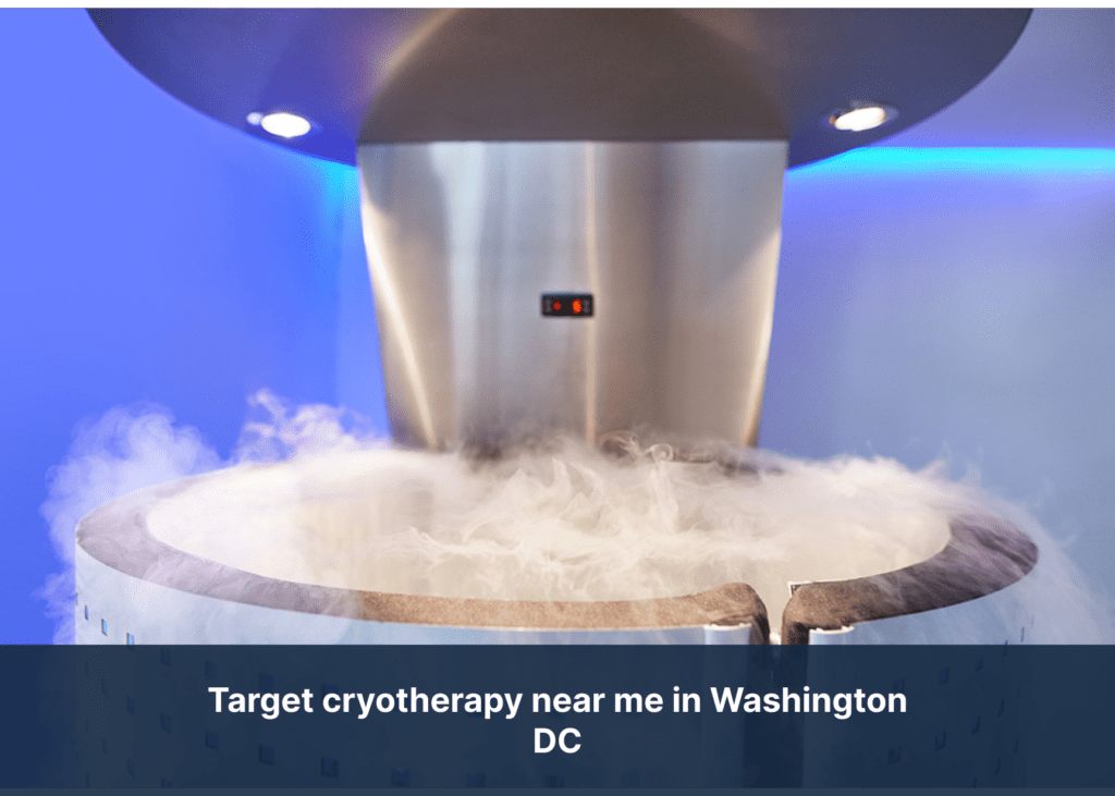 target cryotherapy near me in Washington DC