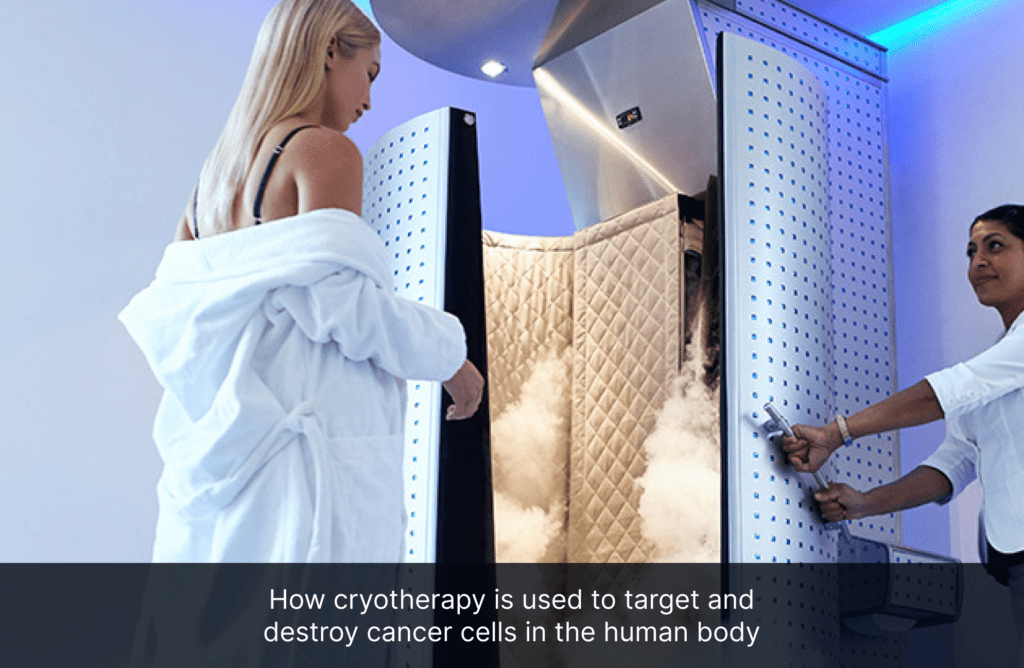 How cryotherapy is used to target and destroy cancer cells in the human body