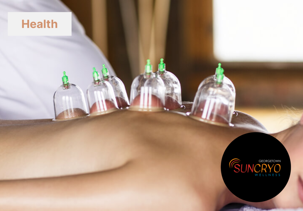 How to schedule a cupping therapy session near Kalorama, DC?