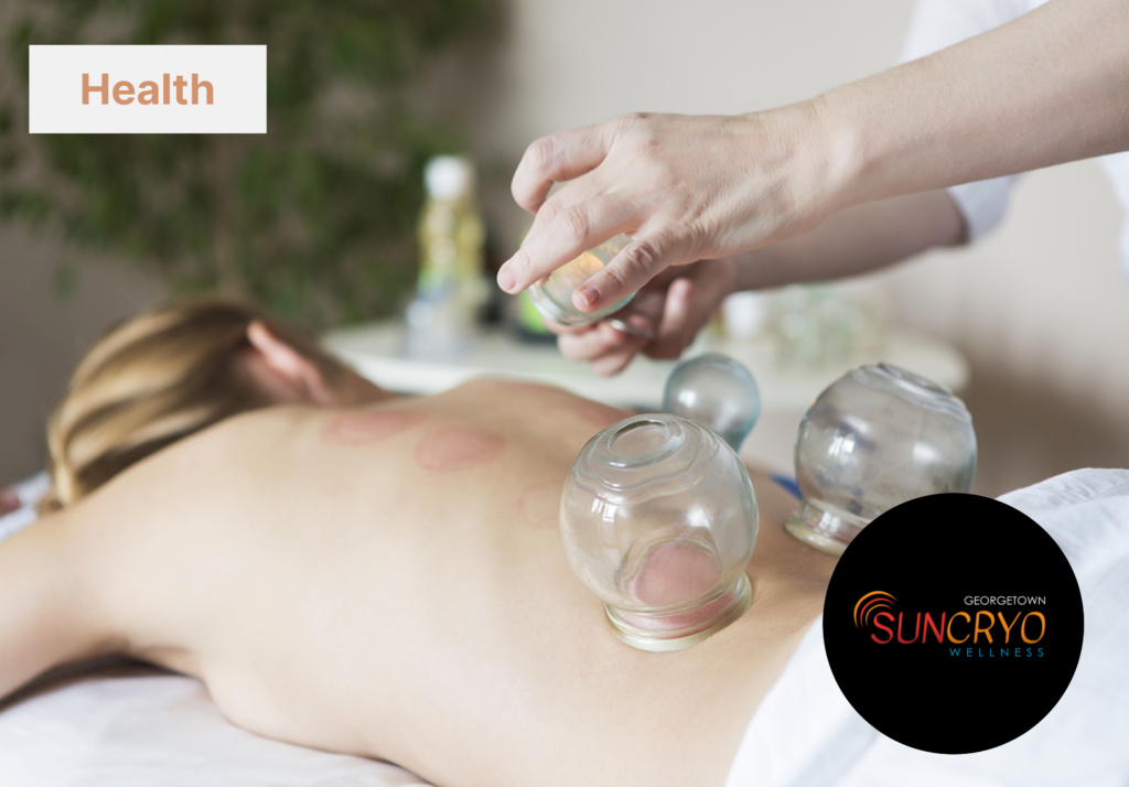 georgetownsuncryo cupping therapy to relieve joint stiffness