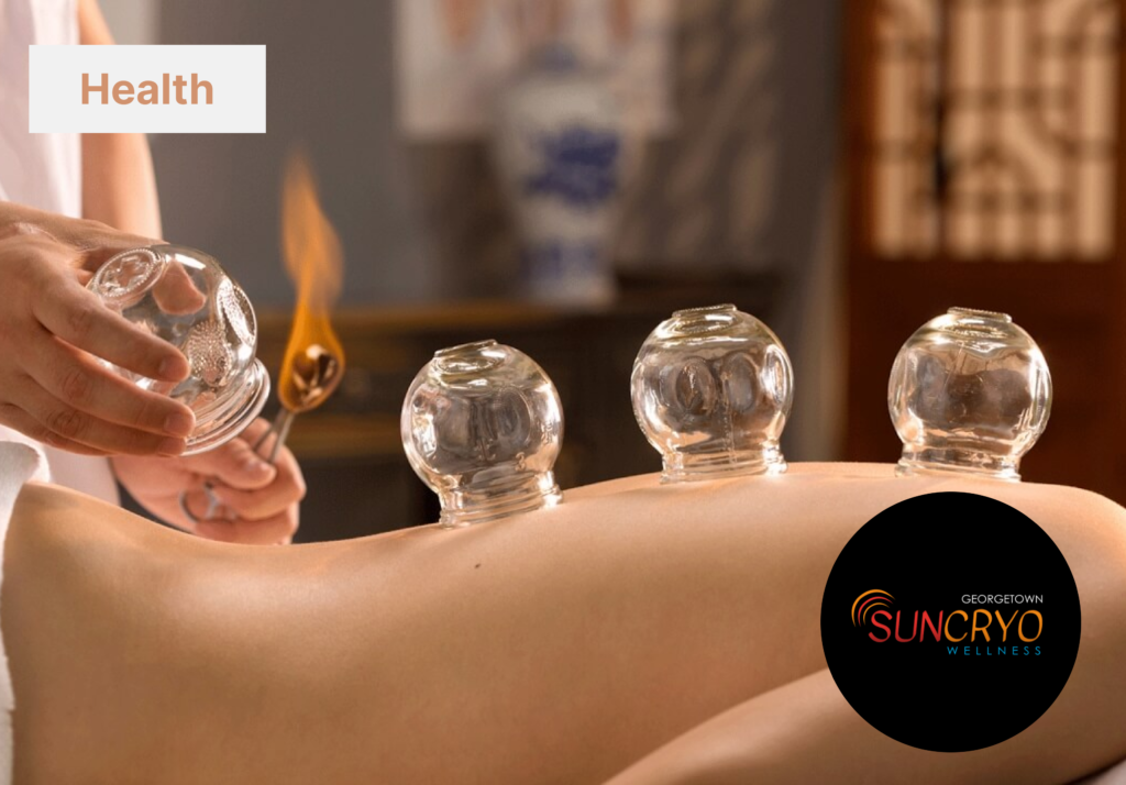 georgetownsuncryo cupping therapy for headaches and migraines