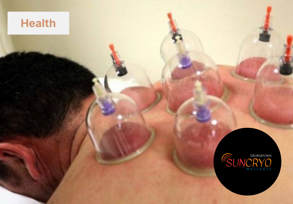 georgetownsuncryo pain management with cupping therapy