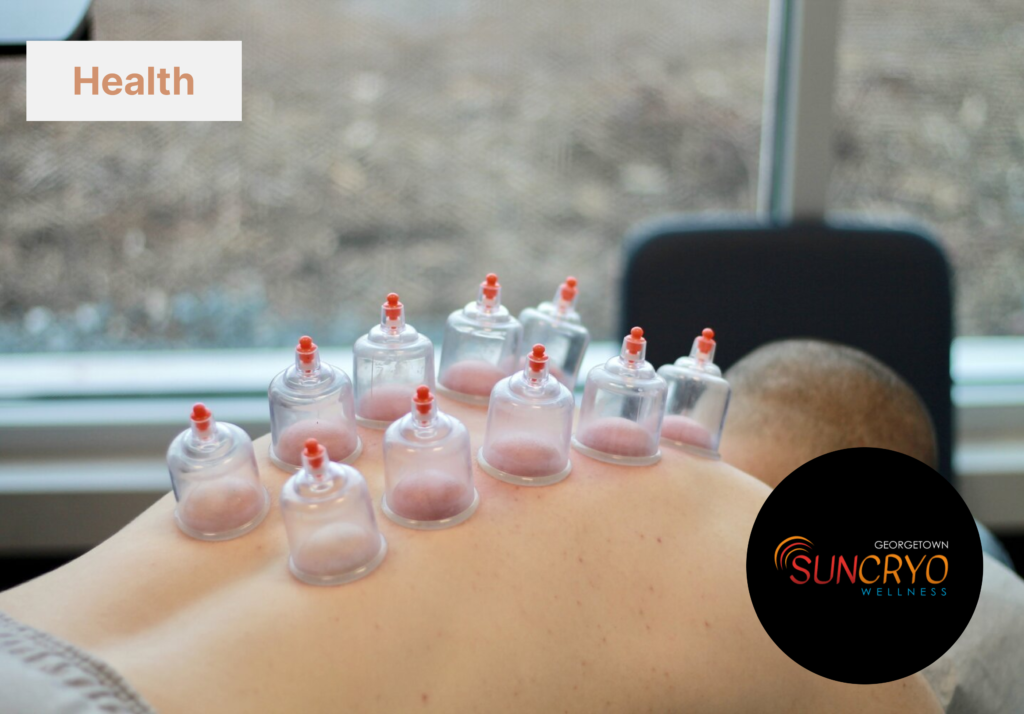 georgetownsuncryo safe and effective cupping therapy