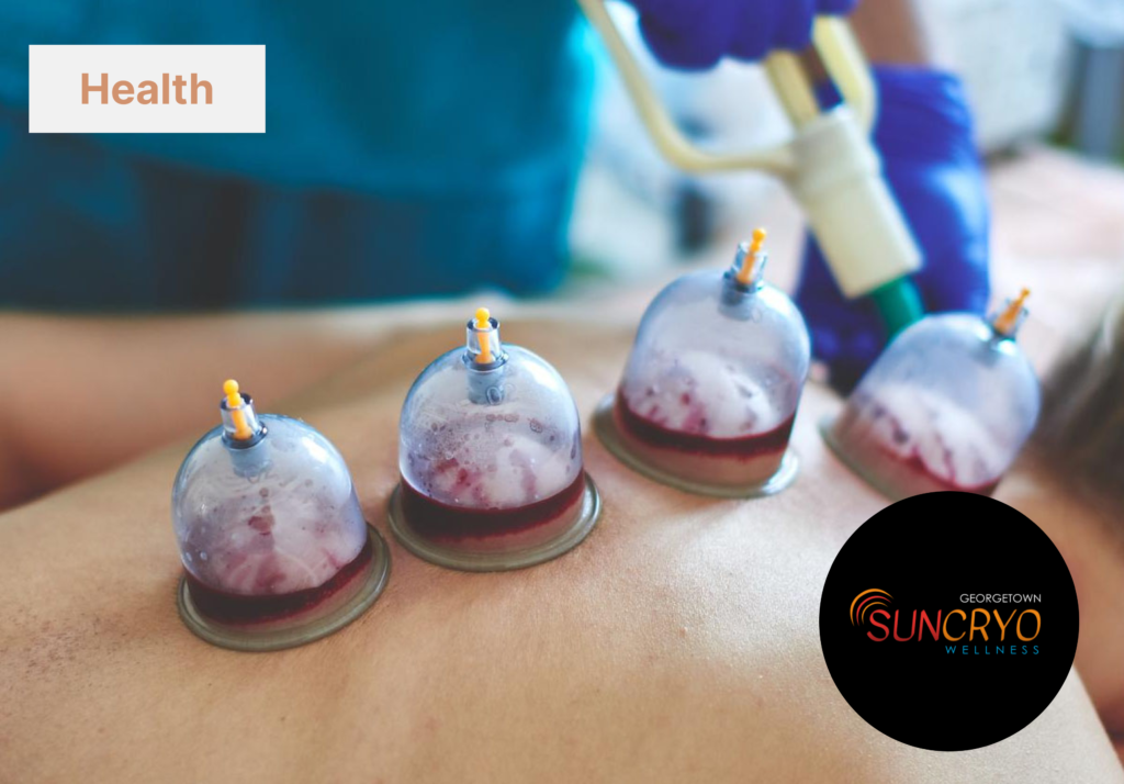 georgetownsuncryo cupping therapy for faster injury recovery