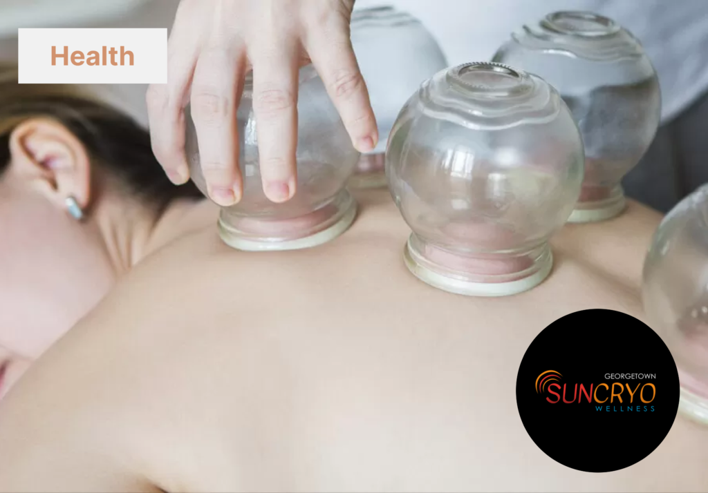 GeorgetownSunCryo Therapeutic Cupping for Overall Health: A Holistic Approach to Wellness