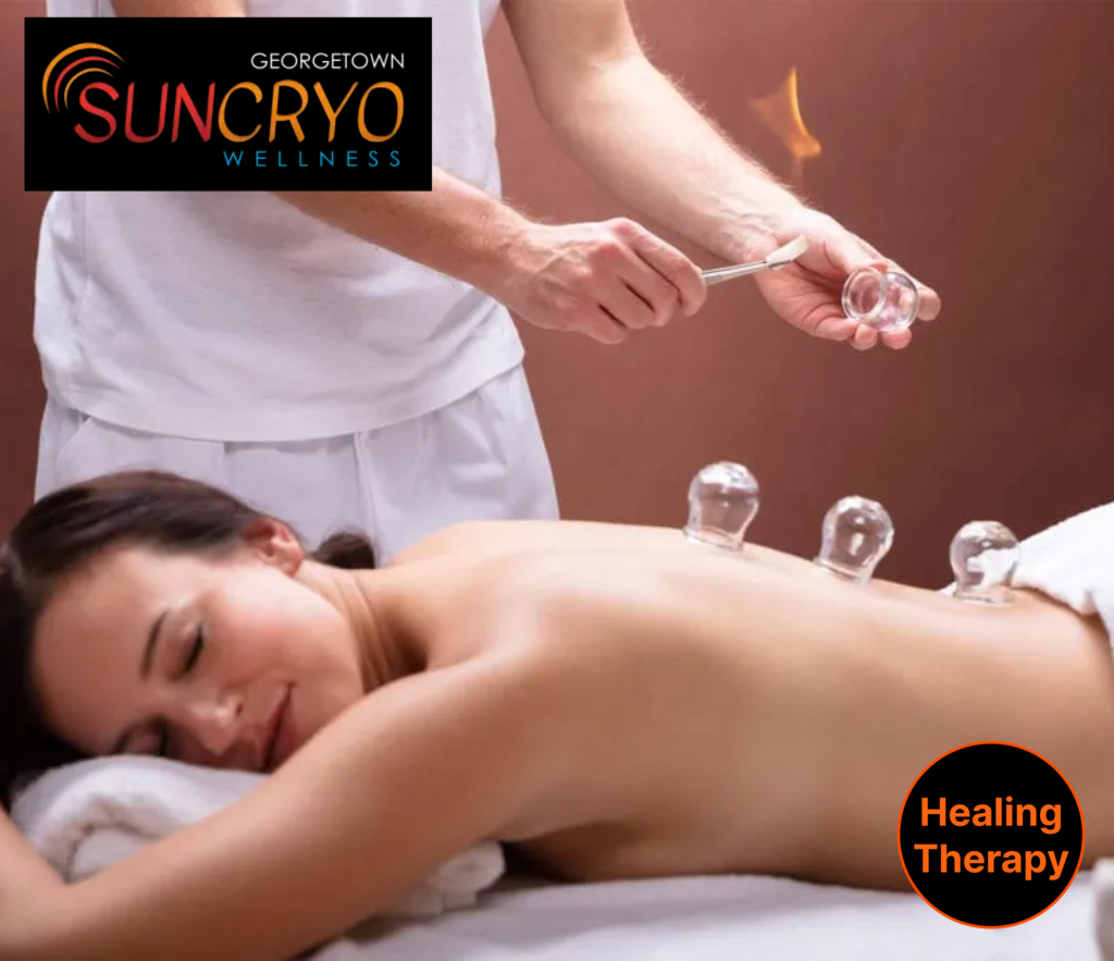 experience-premium-cupping-therapy-near-dupont-circle-at-georgetownsuncryo