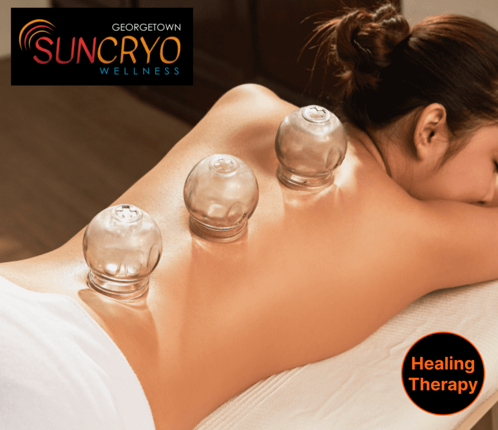 experience-the-finest-cupping-therapy-near-dupont-circle-washington-dc-at-georgetown-sun-cryo