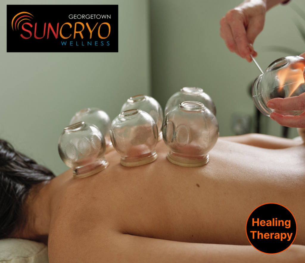 enhance-blood-circulation-with-cupping-therapy-in-dupont-circle-washington-dc