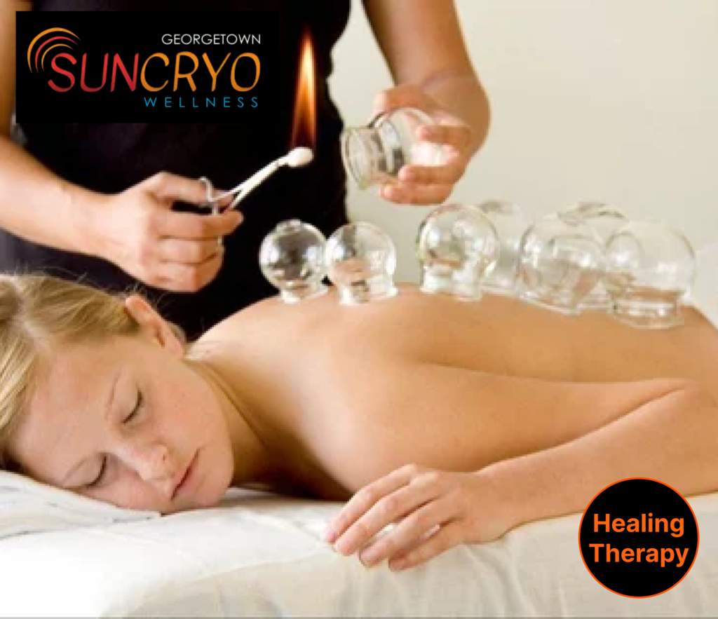 reduce-inflammation-with-expert-cupping-therapy-near-dupont-circle-dc