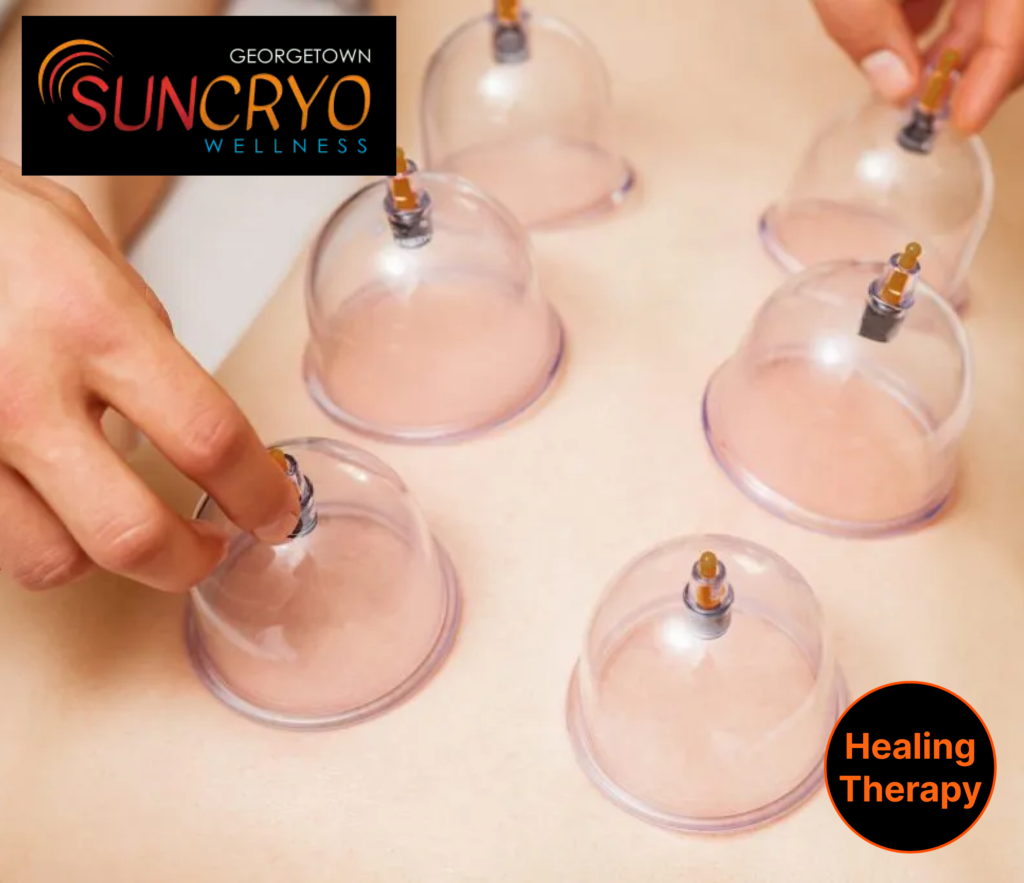 experience-comprehensive-cupping-therapy-at-georgetown-sun-cryo-near-dupont-circle
