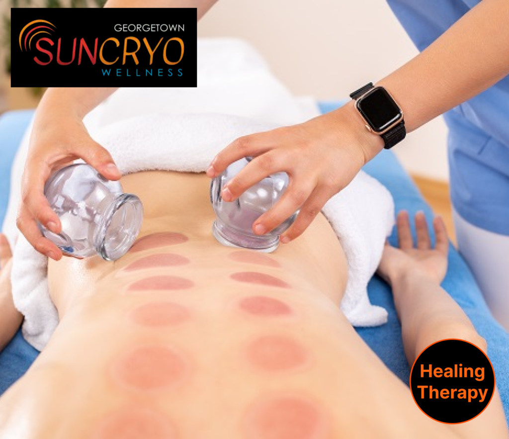 achieve-wellness-goals-with-cupping-therapy-at-georgetown-sun-cryo-near-dupont-circle