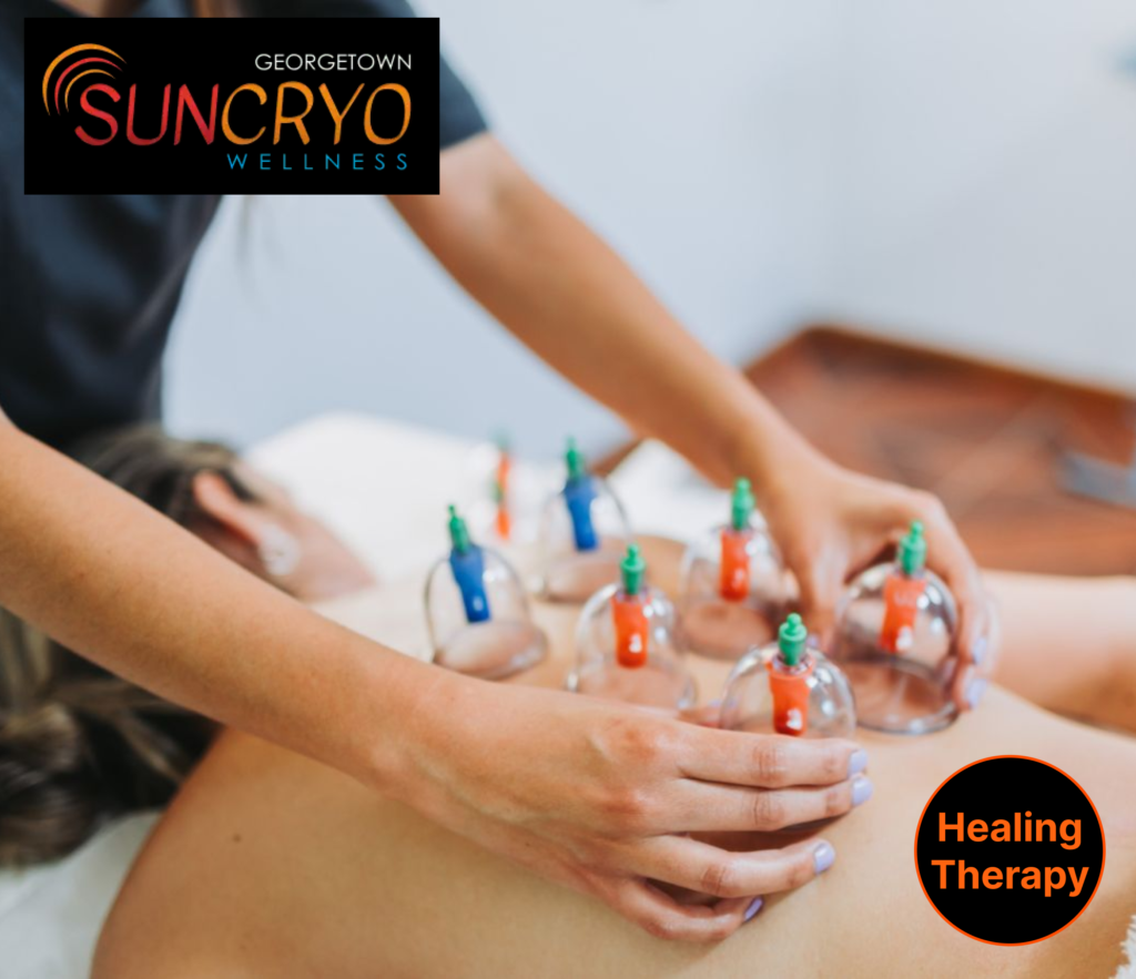 georgetown-sun-cryos-therapeutic-cupping-sessions-near-dupont-circle