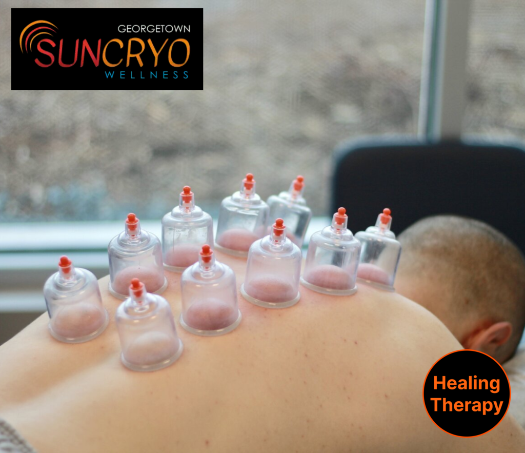 restore-balance-with-cupping-therapy-at-georgetown-sun-cryo-near-dupont-circle