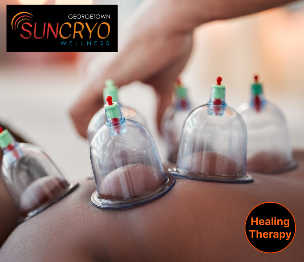 georgetown-sun-cryo-premier-cupping-therapy-services-near-dupont-circle
