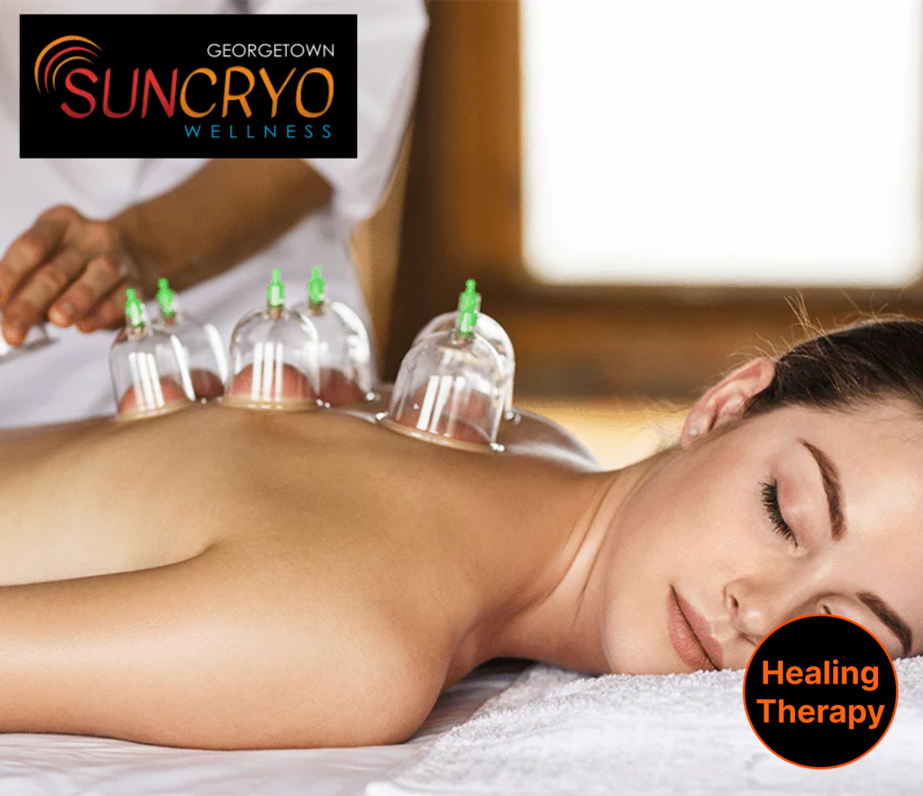 experience-the-benefits-of-cupping-therapy-at-georgetown-sun-cryo-near-dupont-circle