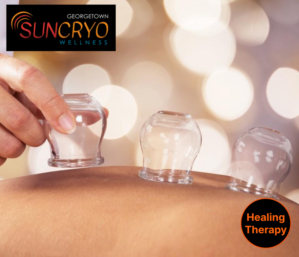 georgetown-sun-cryos-professional-cupping-therapy-near-dupont-circle