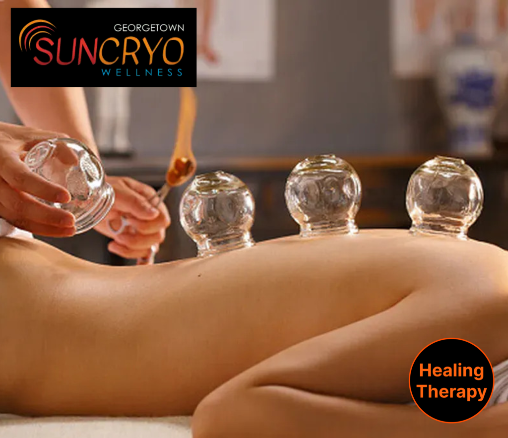 effective-cupping-therapy-for-pain-relief-at-georgetown-sun-cryo-near-dupont-circle