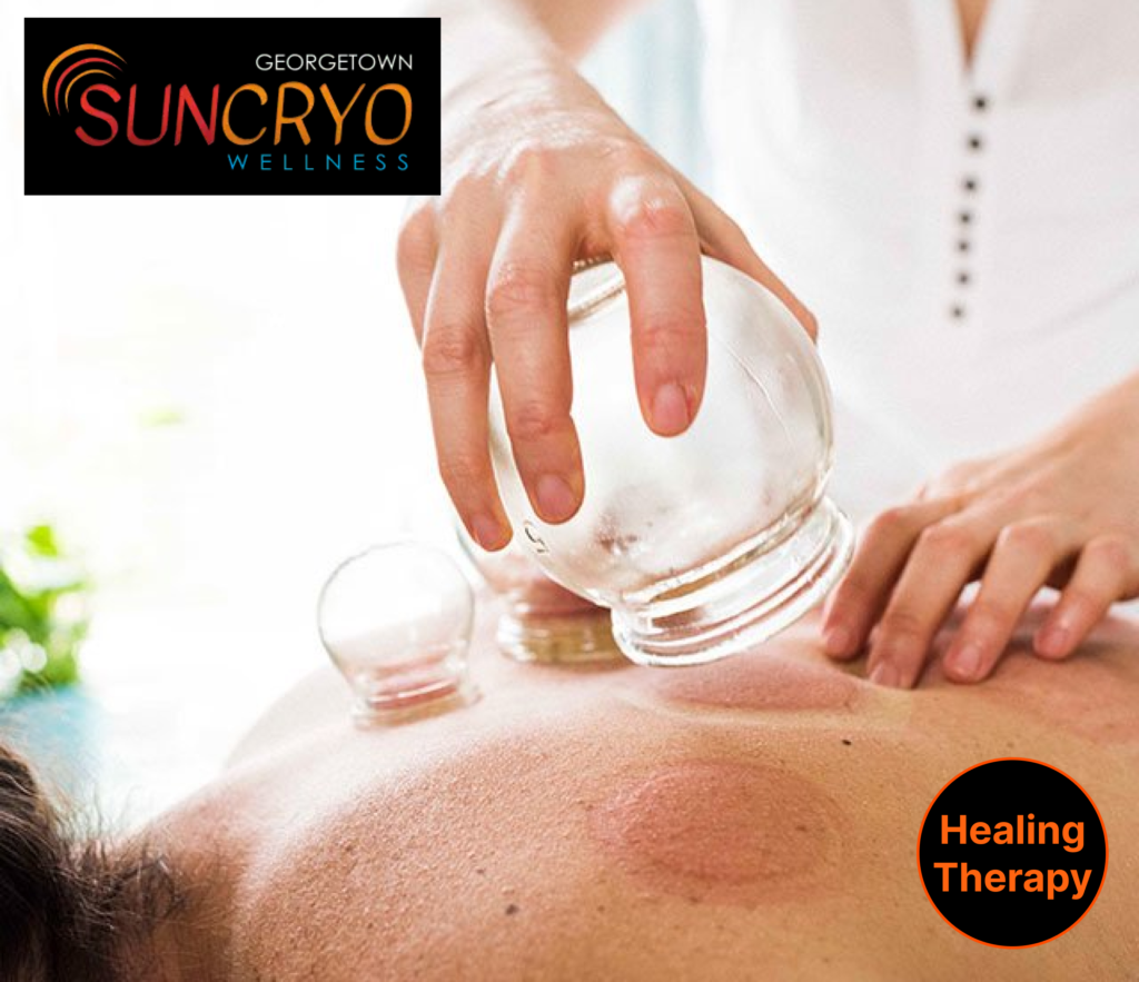 rejuvenate-with-cupping-therapy-at-georgetown-sun-cryo-near-dupont-circle