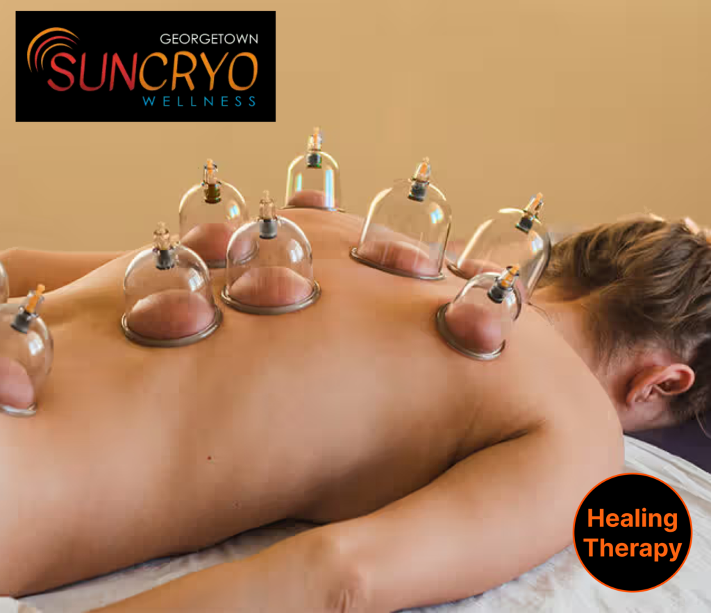 try-advanced-cupping-therapy-near-dupont-circle-for-pain-relief