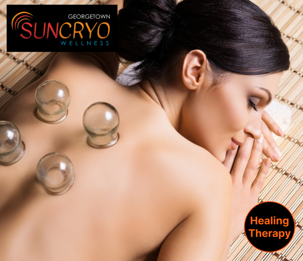 enjoy-the-benefits-of-cupping-therapy-near-dupont-circle-washington-dc