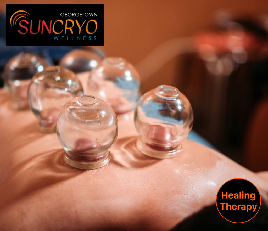 traditional-and-modern-cupping-therapy-services-in-dupont-circle-dc