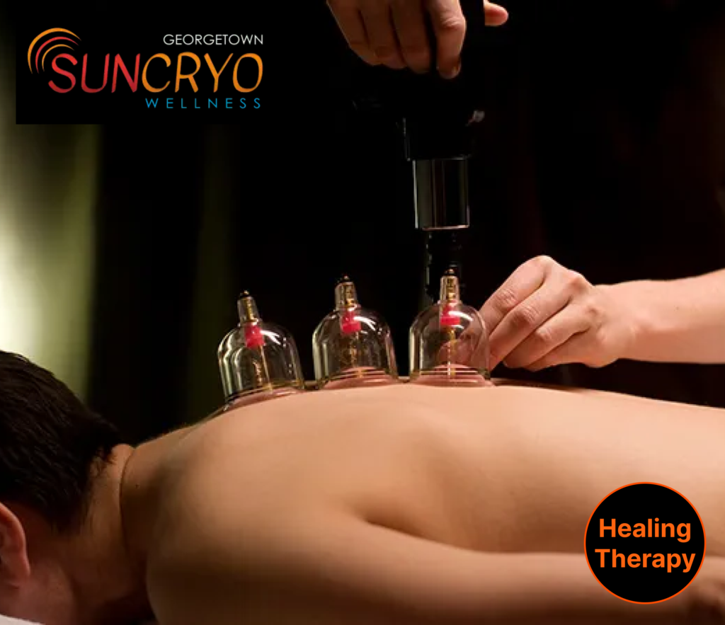 Feel Revitalized with Cupping Therapy near Dupont Circle at Georgetown Sun Cryo