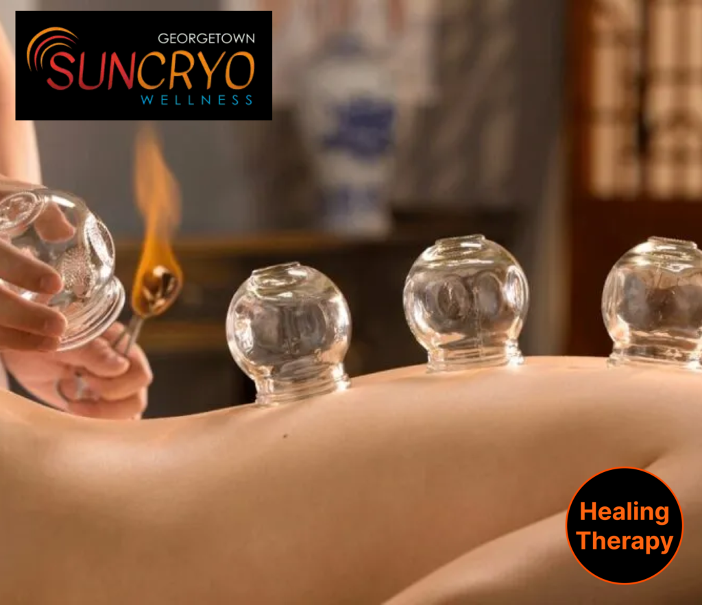trusted-cupping-therapy-professionals-near-dupont-circle-washington-dc