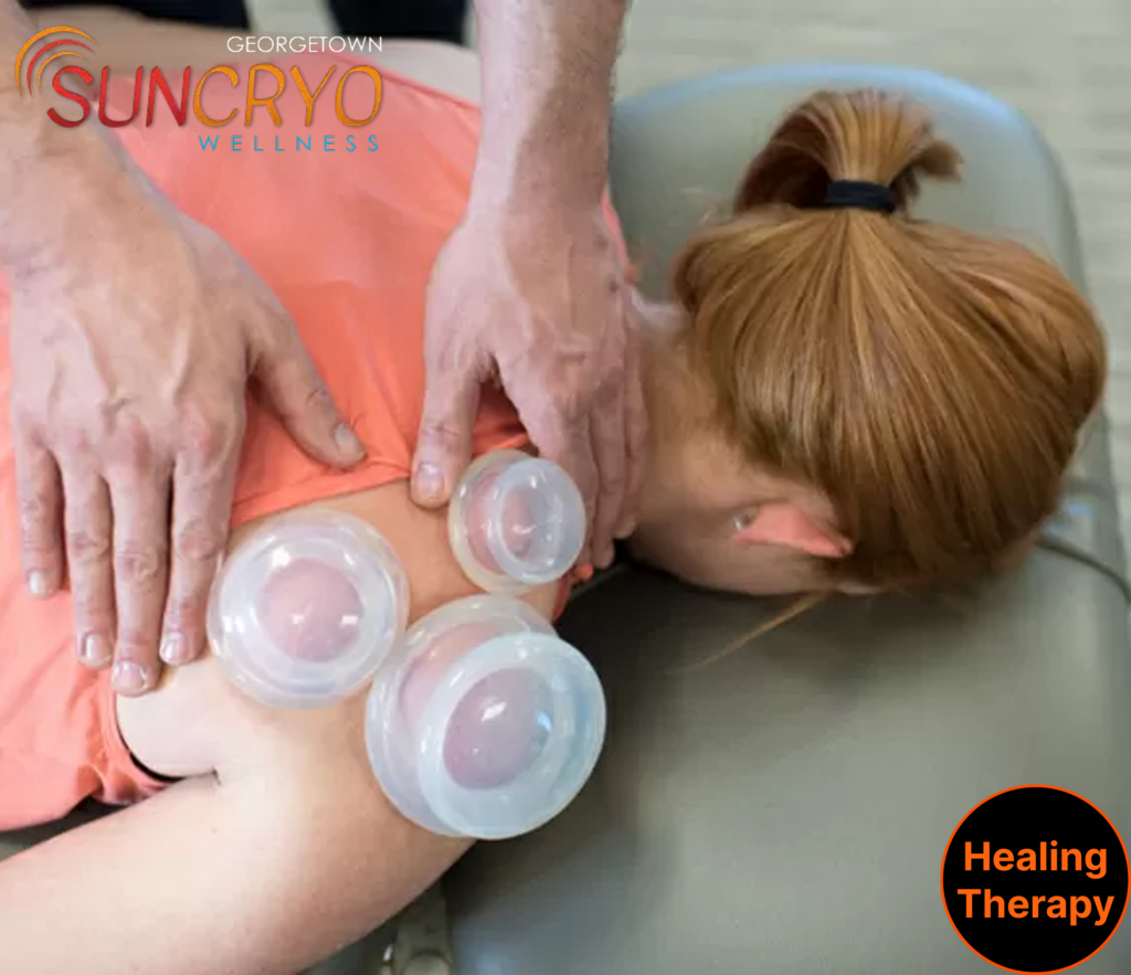 cupping-therapy-at-georgetown-suncryo-in-washington-dc