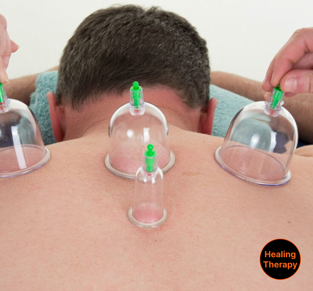 cupping-therapy-for-muscle-recovery-at-georgetownsuncryo-near-georgetown-dc
