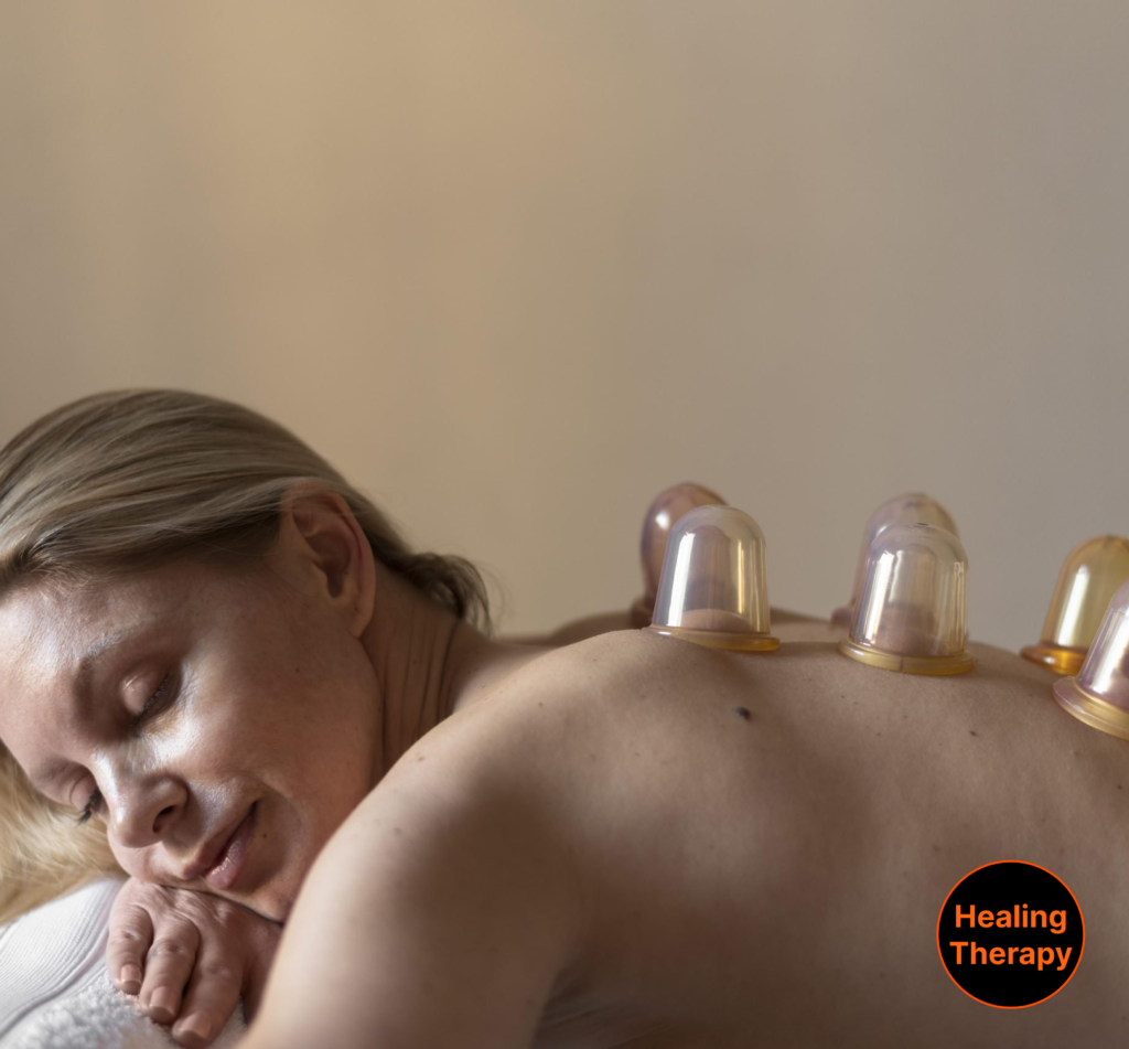 cupping-therapy-for-muscle-tension-relief-in-washington-dc
