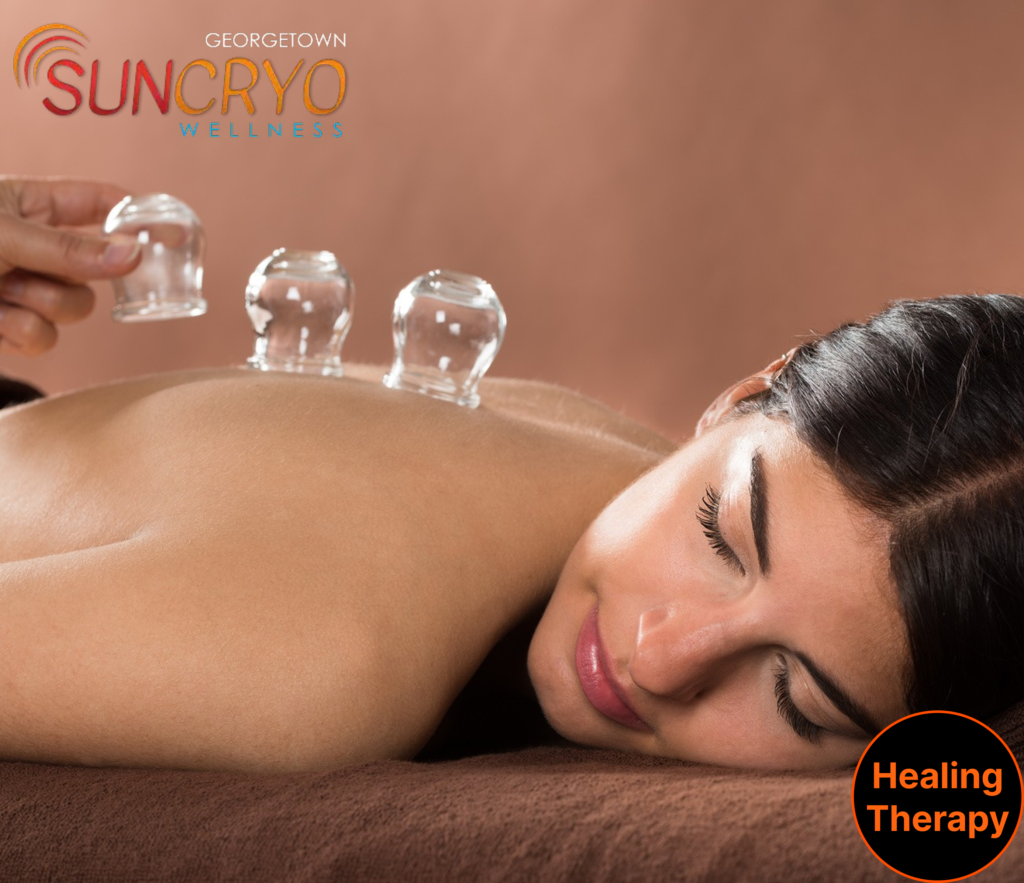 acupuncture-and-cupping-combo-for-womens-health-boost