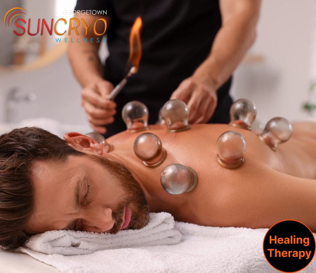 benefits-of-cupping-therapy-at-georgetownsuncryo-for-men-georgetown-dc