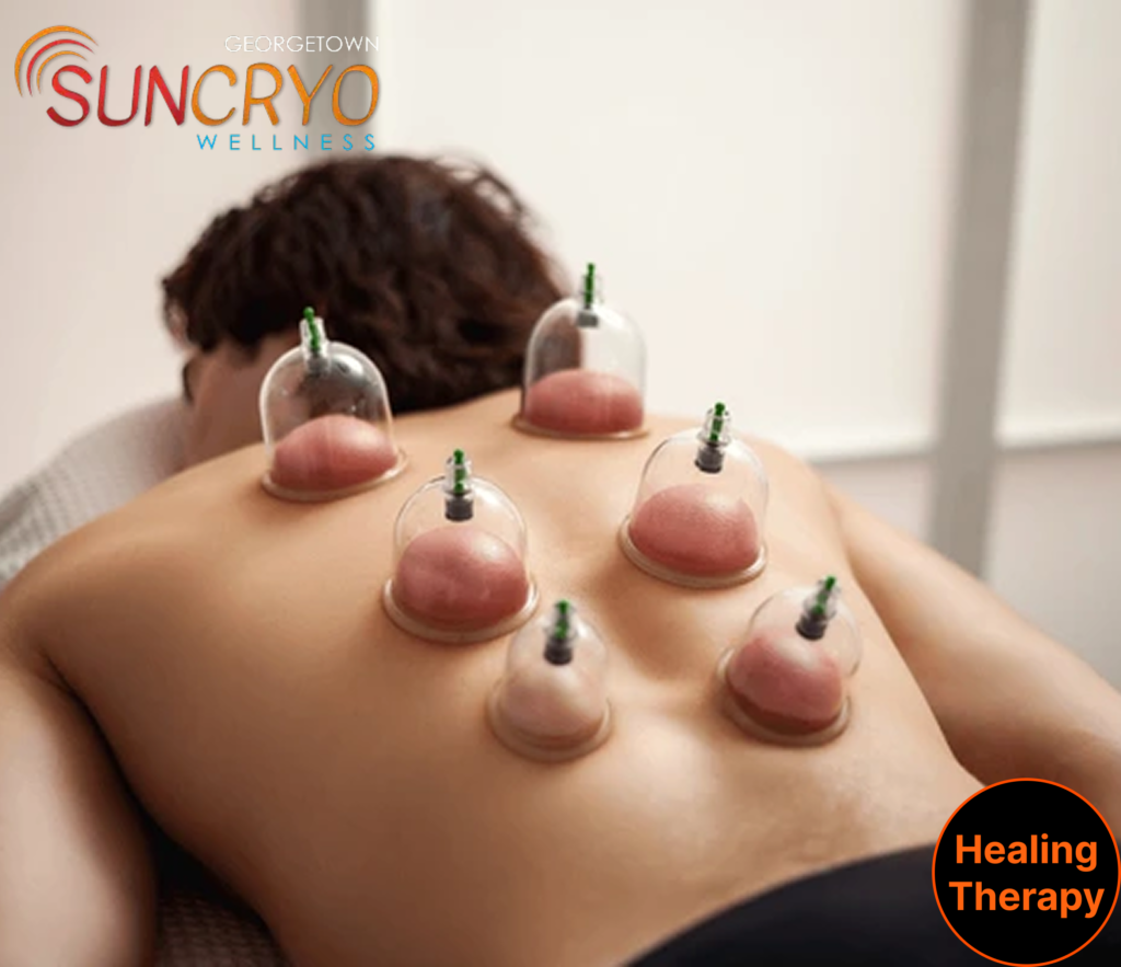 Are you searching for the best cupping therapy near you in Washington, DC? Look no further than GeorgetownSunCryo – your go-to destination for professional cupping therapy