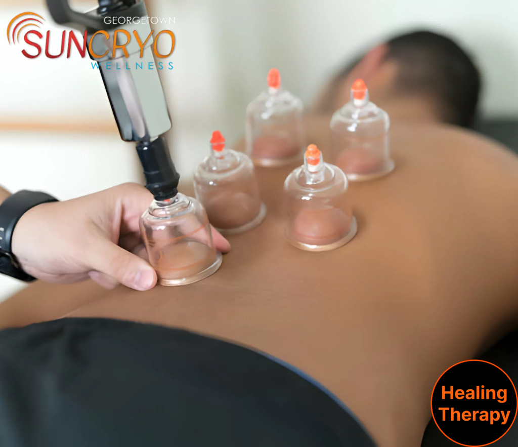cupping-therapy-for-muscle-tension-for-men-at-dc-georgetownsuncryo