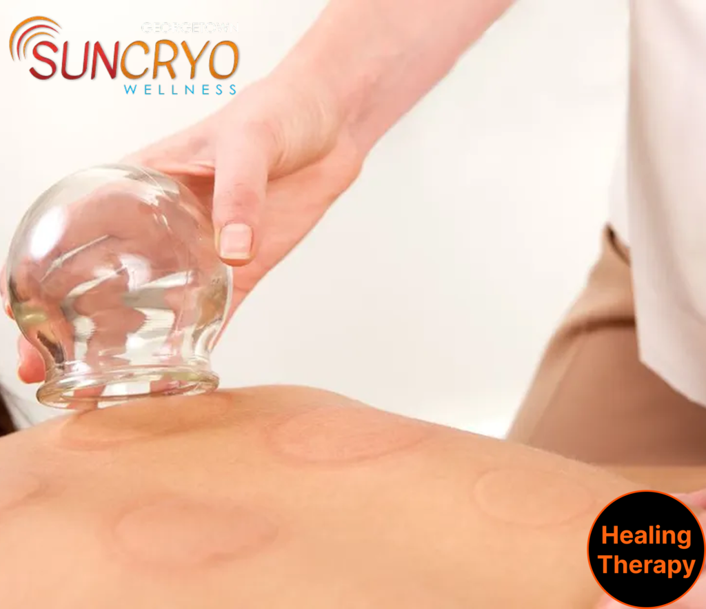 cupping-therapy-for-athletes-at-dc-georgetown-suncryo-boost-recovery-reduce-pain-elevate-performance