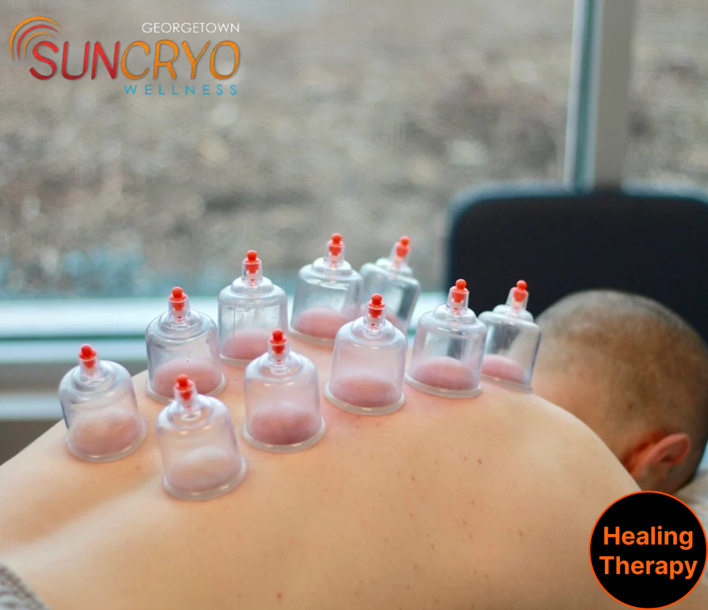 sports-recovery-cupping-dc-benefits-for-athletes-at-georgetown-suncryo