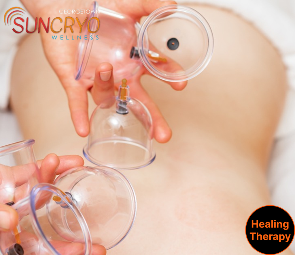 muscle-recovery-with-cupping-therapy-near-19th-street-dc-only-at-georgetown-suncryo