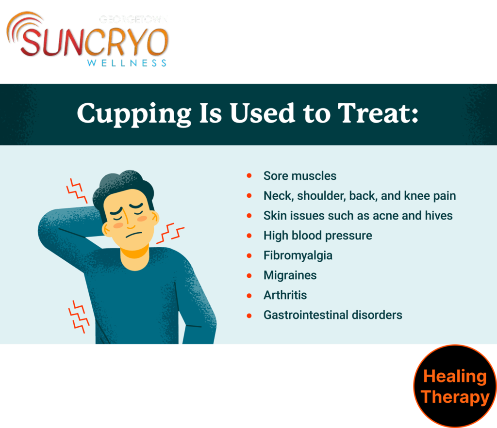 cupping-therapy-for-cellulite-near-19th-street-dc-only-at-georgetown-suncryo