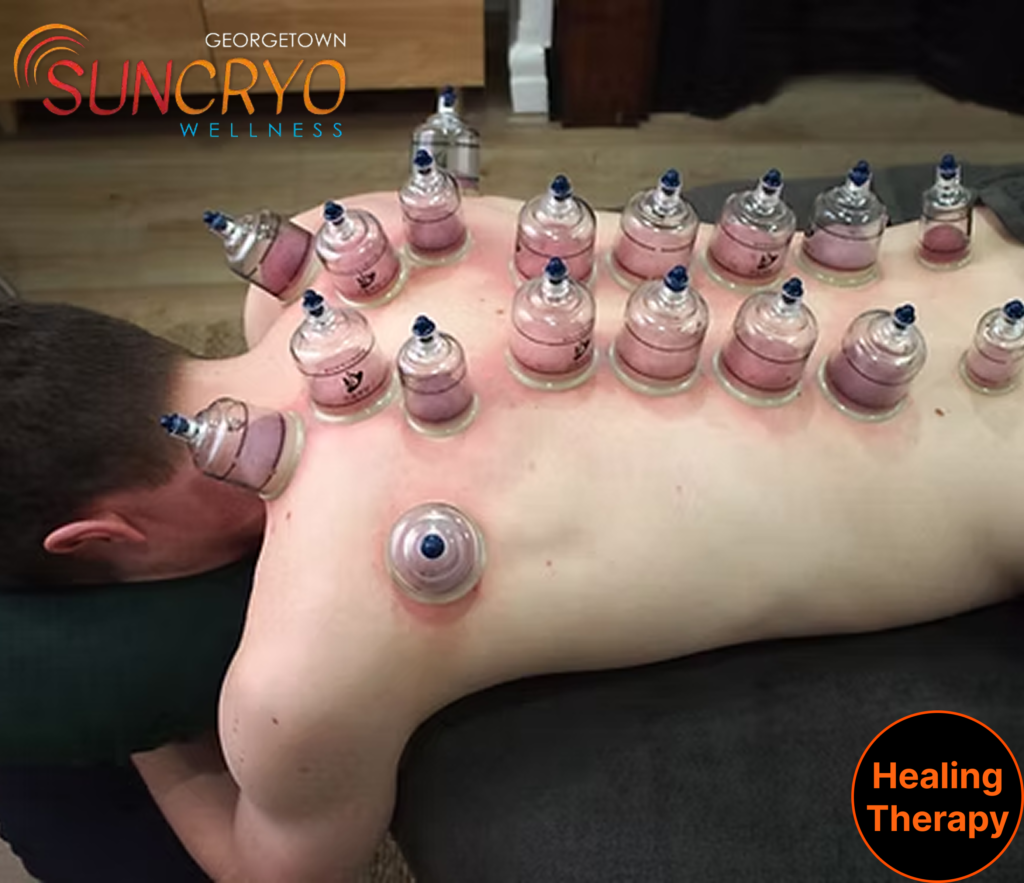 skin-rejuvenation-with-cupping-near-19th-street-dc-only-at-georgetown-suncryo