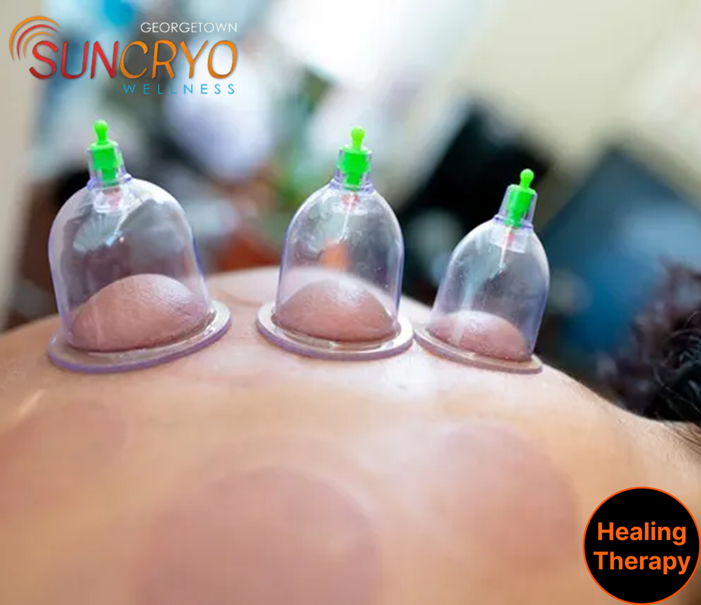 anti-aging-cupping-therapy-at-georgetown-sun-cryo-washington-dc-usa