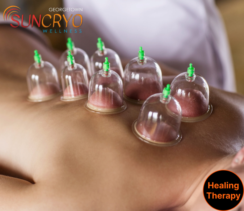 experience-deep-healing-fire-or-vacuum-cupping-combined-with-massage-at-georgetownsuncryo