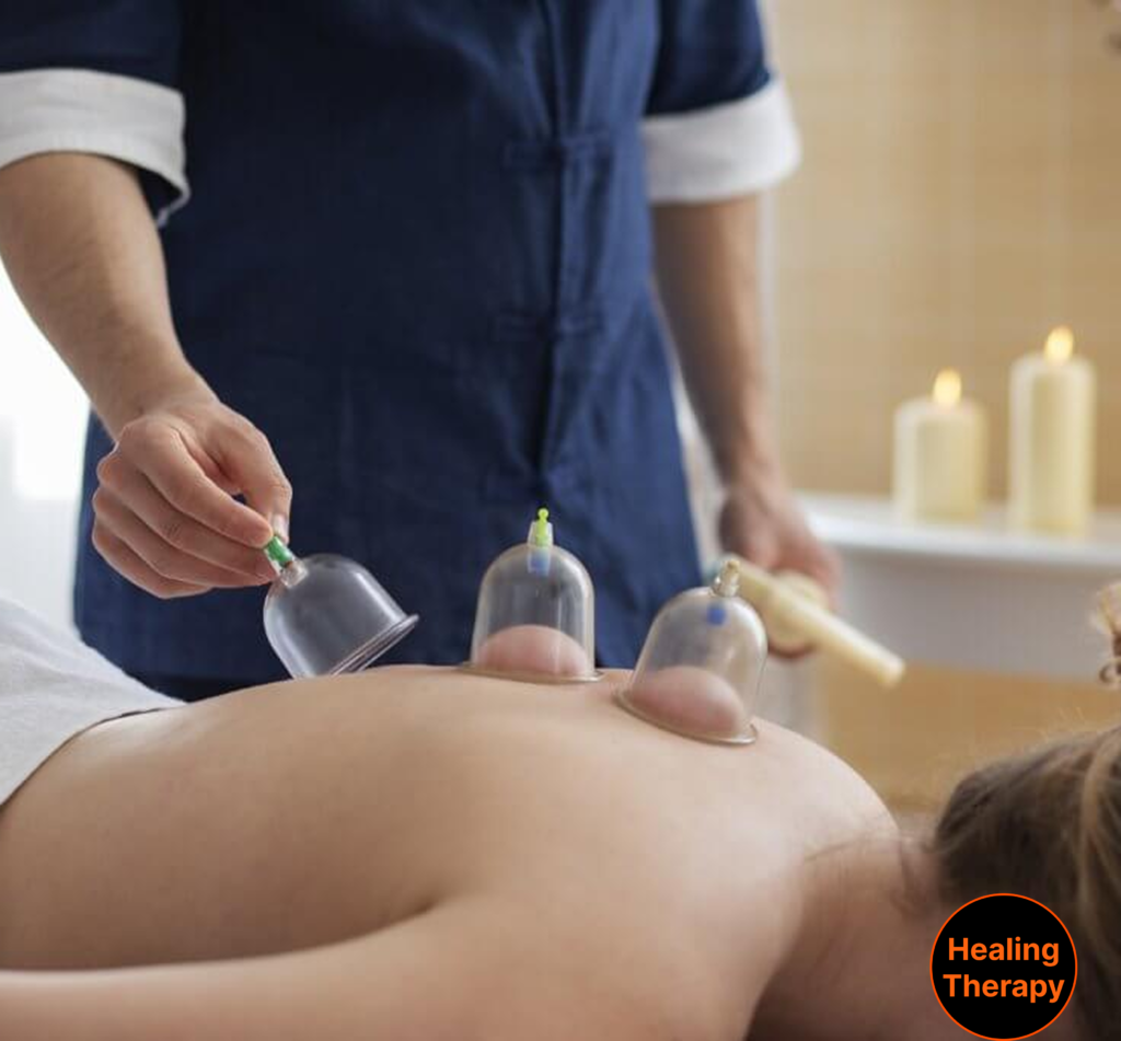 Stress Relief and Relaxation with Cupping Therapy at GeorgetownSunCryo near Georgetown, DC