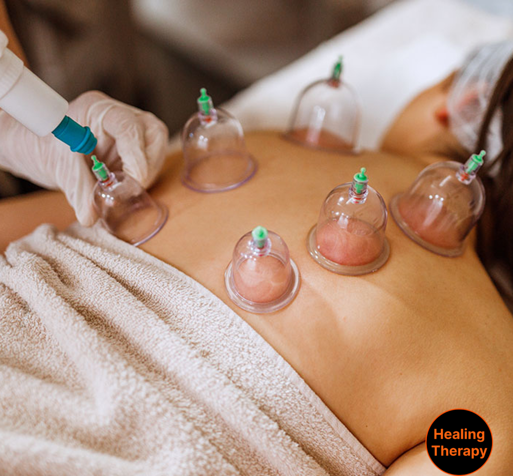 natural-cupping-therapy-for-womens-health-boost-georgetownsuncryo-washington-dc
