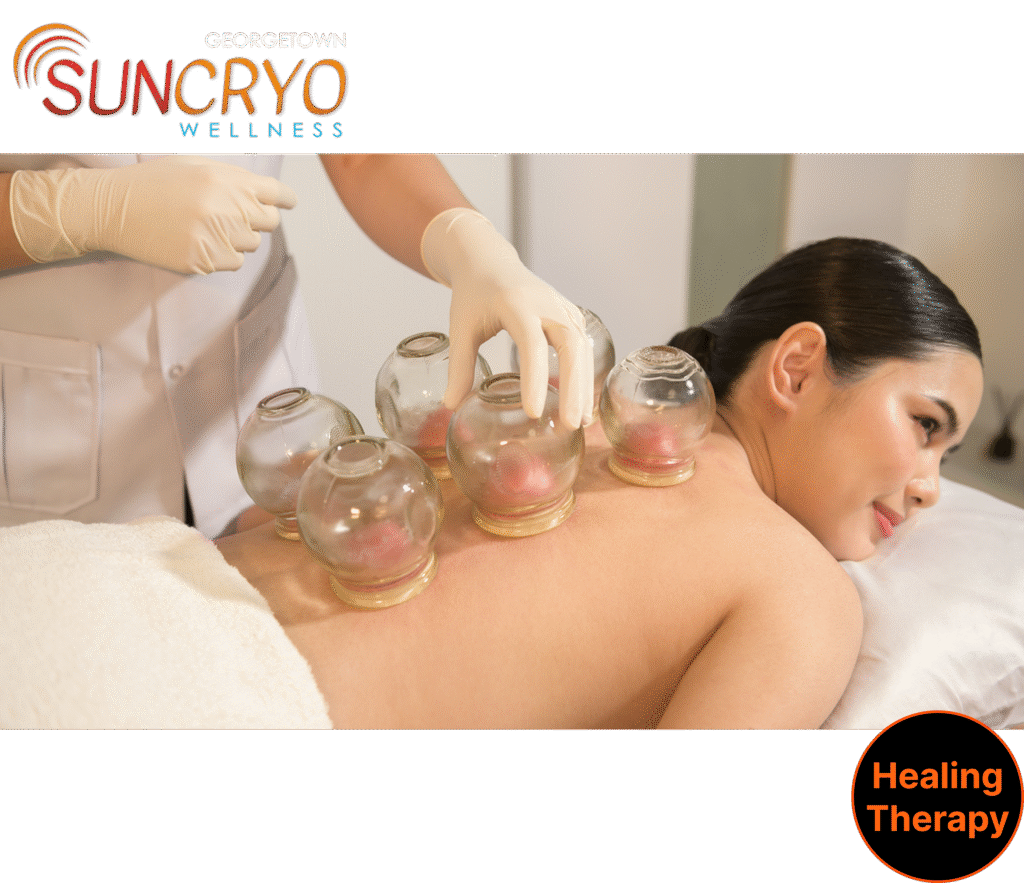 cupping-therapy-near-coconut-grove-miami-fl-and-washington-dc-georgetown-suncryo